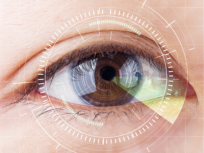 La chirurgie des yeux exige une extrême précision. La technique laser permet aujourd'hui aux médecins de travailler de manière encore plus précise qu'avec un scalpel.